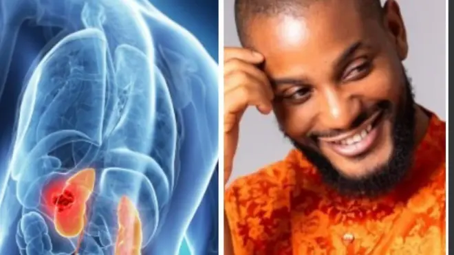 Aworan Kindinrin to bajẹ ati Alex Ekubo