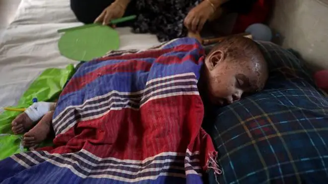 ৯ মাসের আগে শিশুরা হাম বা মিজলস ভাইরাসে আক্রান্ত হয়না?