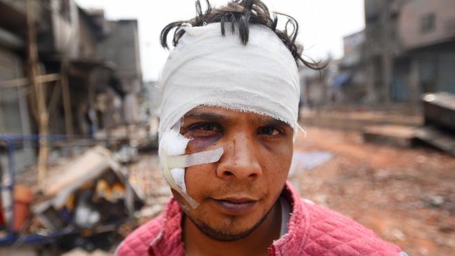 दिल्ली हिंसा में घायल एक शख़्स
