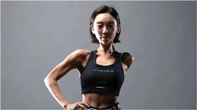 김 씨는 팔을 잃고 나서 "할 수 있는 게 더 많아졌다"고 했다.