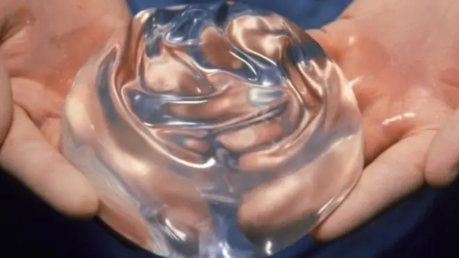 مبادرة وزارة الصحة جاءت لتجنب أي فضائح طبية شبيهة بفضيحة سليكون تكبير الثدي من شركة بي أي بي عام 2010