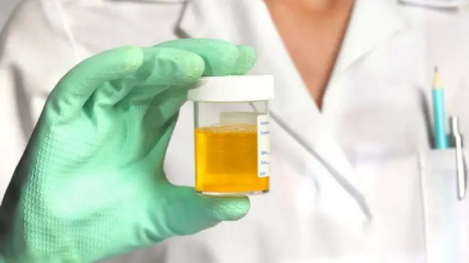 กล่องบรรจุปัสสาวะ