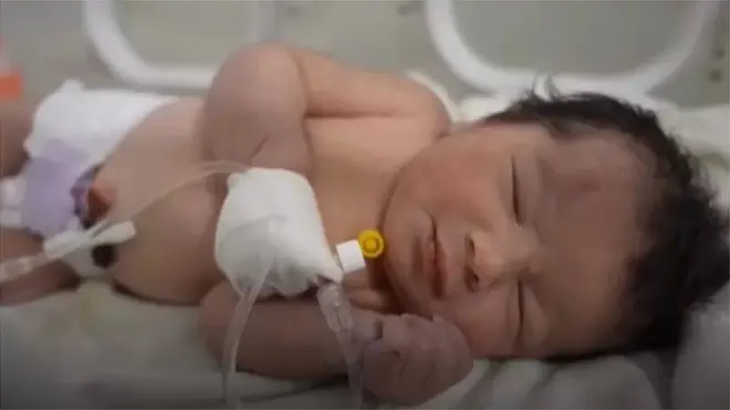 ही नवजात मुलगी जेव्हा सापडली, तेव्हा तिची नाळही तशीच होती. पण तिच्या आईचा मृत्यू झाला होता.