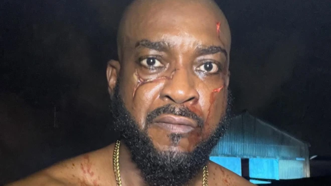 Chidi Mokeme as Scar