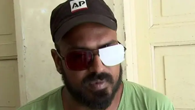 کشمیری فوٹو جرنلسٹ ضہیب بٹ جو بھارتی فورسز کی کارروائی میں زخمی ہوئے