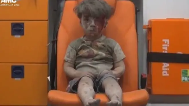 Halep'te enkaz altından çıkartılan beş yaşındaki Ümran ambulansta otururken