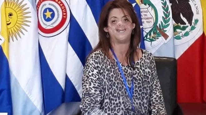 Fide Mirón afise imyaka 46 kandi nta kindi kintu kindi azi mu buzima bwiwe kiretse urugamba n'indwara yiwe.