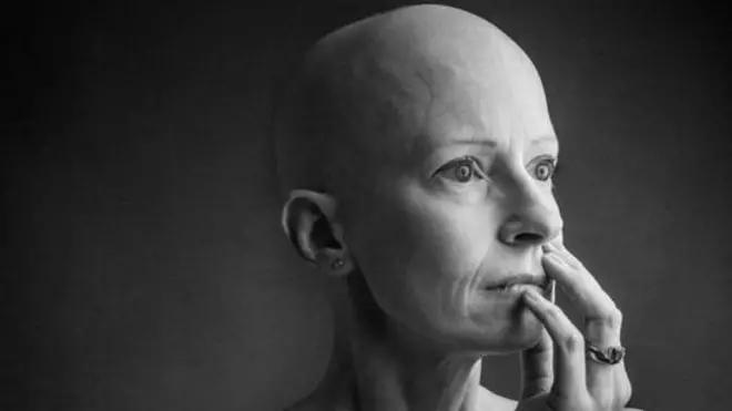 ڈاکٹر لِز او ری اورڈن کو پہلی مرتبہ سنہ 2015 میں بریسٹ کینسر ہوا تھا