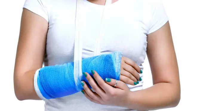 Девушка со сломанной рукой