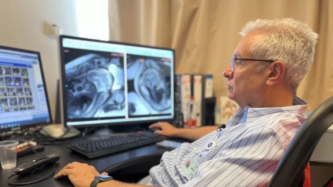 Чен Хоффманн