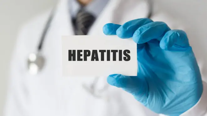 325 millones de personas en todo el mundo sufren de hepatitis crónica.