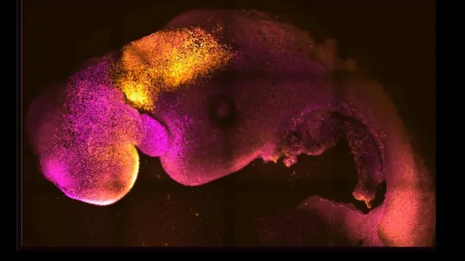 Natural and synthetic embryos, side by side, show comparable brain and heart formation, scientist say