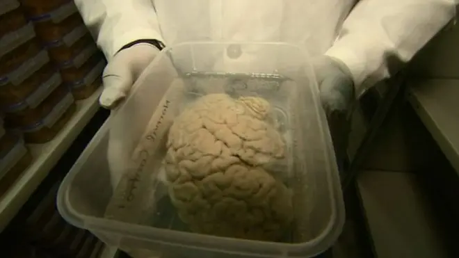 انسانی دماغ