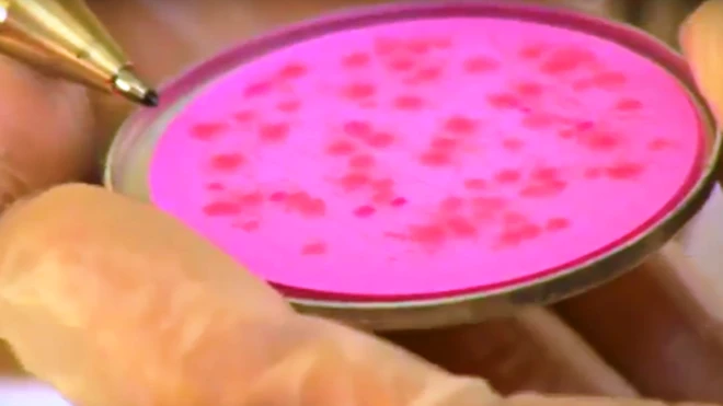 نتایج آلودگی آب دو منطقه شهر کابل روی کاغذهای‌ مخصوص دایره‌ای شکل به شعاع حدود سه سانتی‌متر نشان داده شده، هر نقطه نشان‌گر یک باکتری است