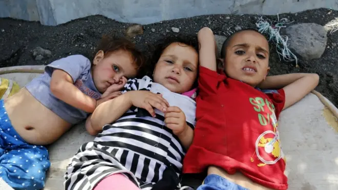 تفشى مرض الكوليرا مؤخرا في اليمن