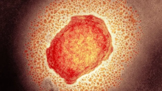 Monkeypox virus particle