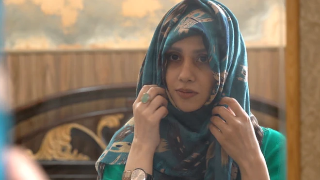 ایلوپیشیا کا شکار خاتون