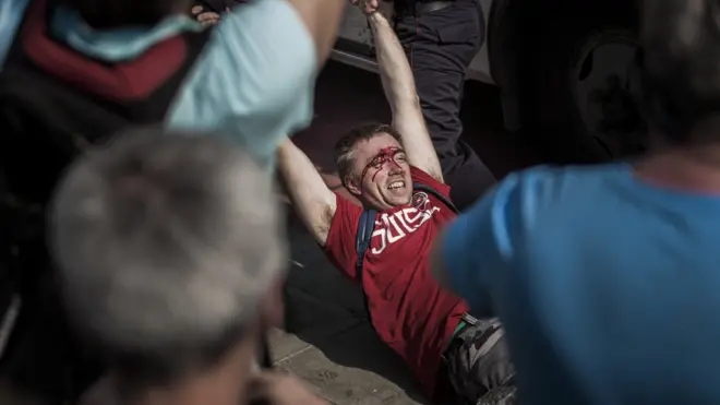 Избитый человек