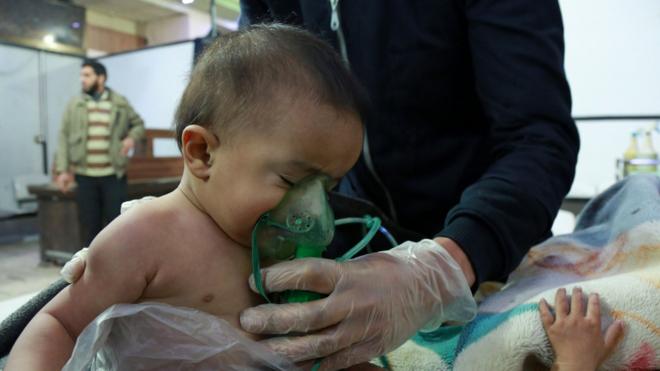 Syrian babies receive treatment for a suspected chemical attack in the Eastern Ghouta region on February 25, 2018