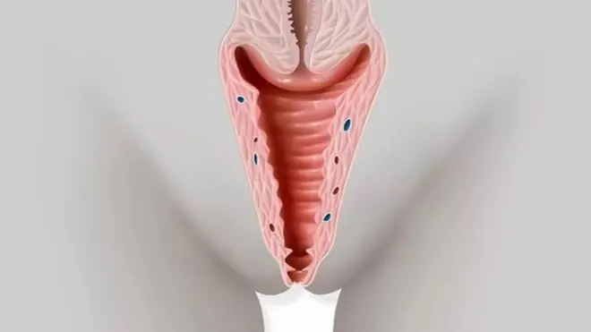 aworan oju ara obinrin