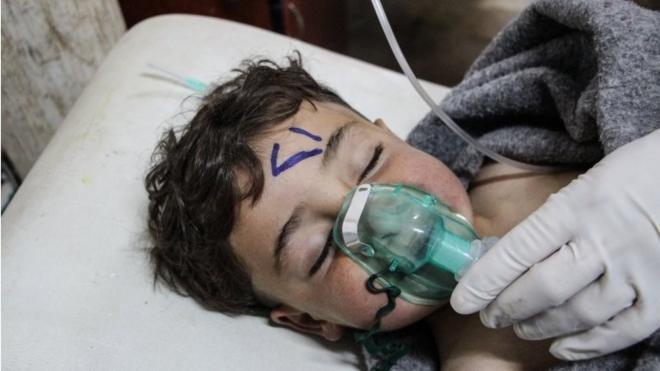 طفل سوري تعرض لهجوم كيماوي