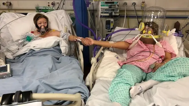 እታ ስእሊ ብሕማም ኮቪድ ናይ ዝተተንከፋ ኣደን ጓልን ስእሊ እያ