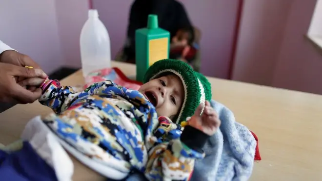 الأمم المتحدة: "آلاف لا حصر لها" ستموت ما لم ترفع السعودية الحصار عن اليمن