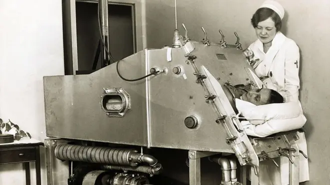 Dinamarca solo tenía un respirador de hierro cuando empezó a sufrir los efectos de la epidemia de polio.