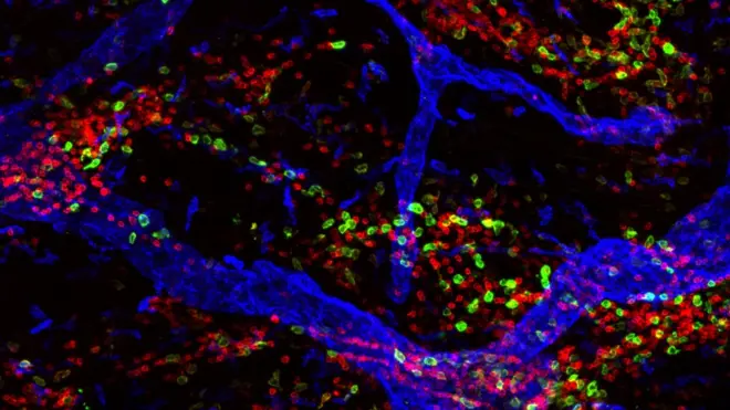 Arquitectura celular de la piel humana normal. Wellcome Images.