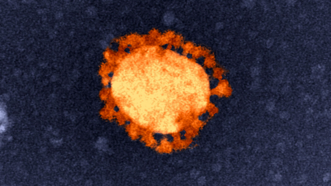 The coronavirus SARS CoV-2