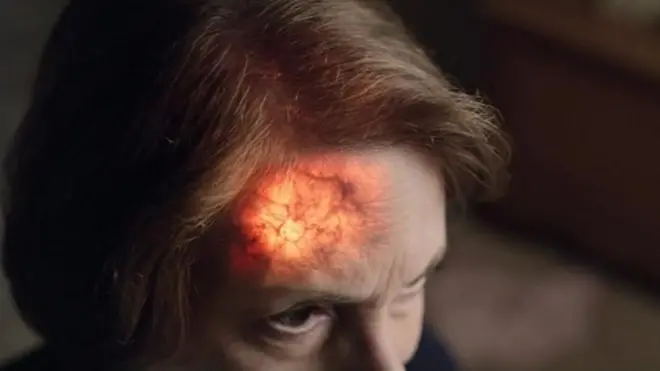 Време игра важну улогу од тренутка када пацијент уочи прве симптоме можданог удара