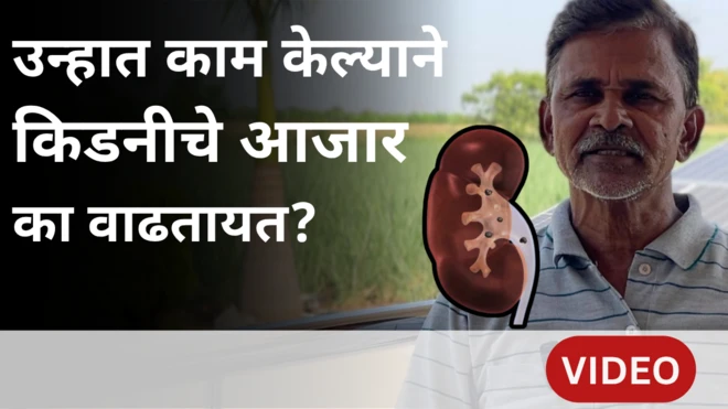 प्रातिनिधिक 