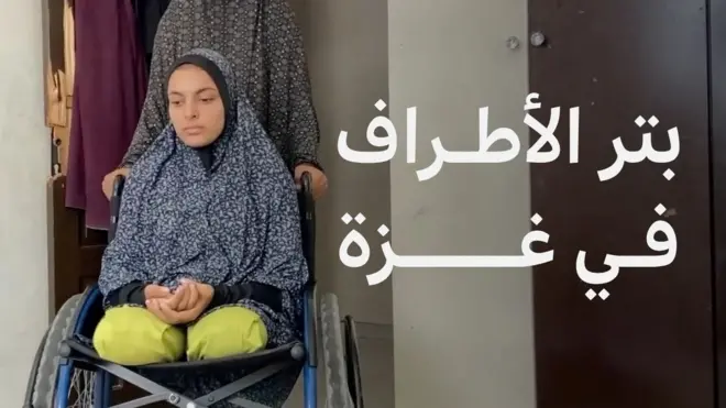 بتر الأطراف