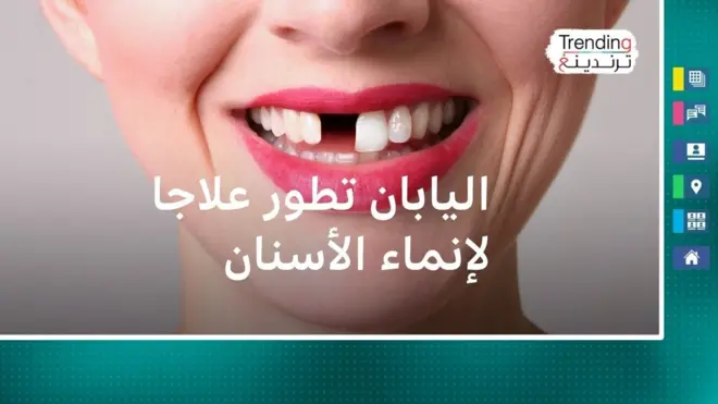 اليابان تطور أول علاج لإنماء الأسنان 