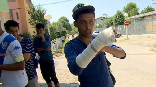 Jedan od migranata pokazuje na ruku u zavoju