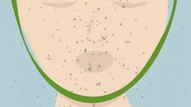 هل العالم مستعد لمواجهة فيروس كورونا؟