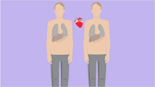 Первая трансплантация сердца прошла в 1967 году.