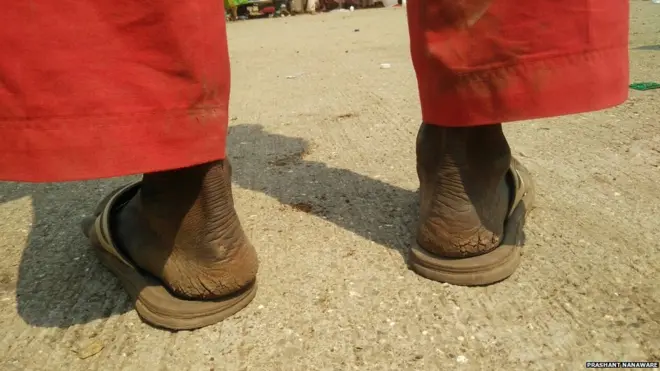 પગનો ફોટો