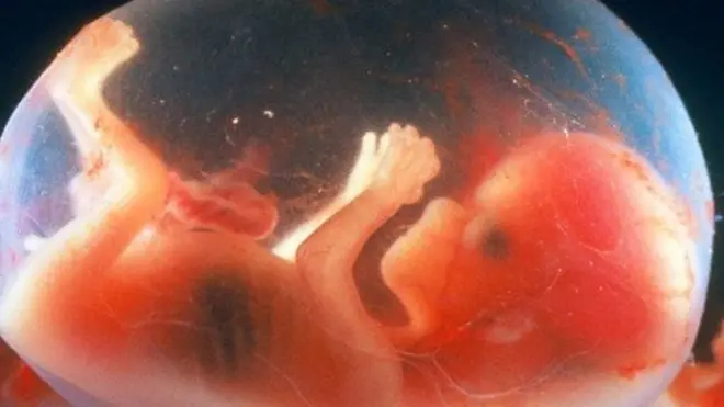 14 सप्ताह का भ्रूण