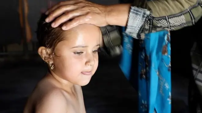 طفلة سورية في مخيم اللاجئين في إدلب تستحم بالماء لمحاولة تخفيف درجة حرارتها أثناء مرضها