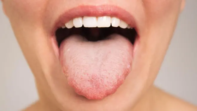 Lengua 