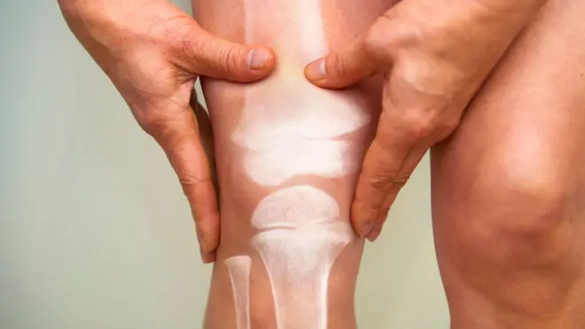 కీళ్ల వాపు