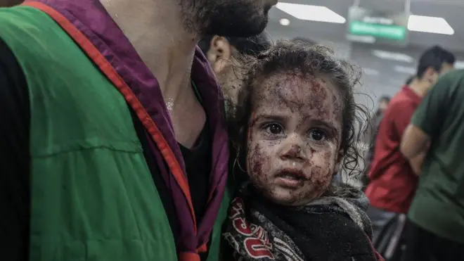 Una niña superviviente del ataque es atendida en otro hospital.
