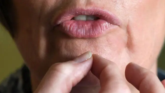 Заїкання підвищує соціальну тривожність та часто стає приводом для глузування чи дискримінації з боку інших