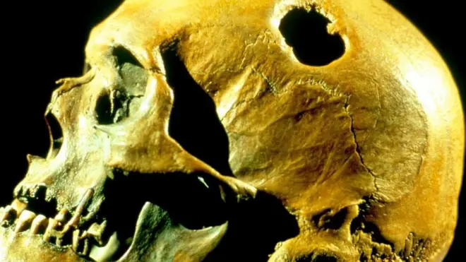 ખોપડીની પ્રતીકાત્મક તસવીર