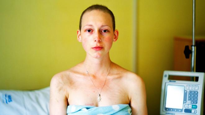 Sua fotografia intitulada 'Último dia de quimioterapia' foi selecionada para o Portrait of Britain Awards 2018