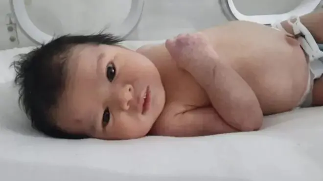 सीरिया, तुर्की, बाळ