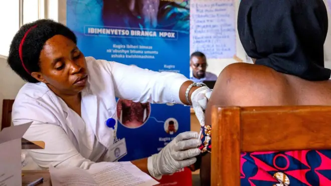 Umukozi urimo gukingira Ubushita bw'inkende nk'uko bivugwa na minsiteri y'ubuzima y'u Rwanda