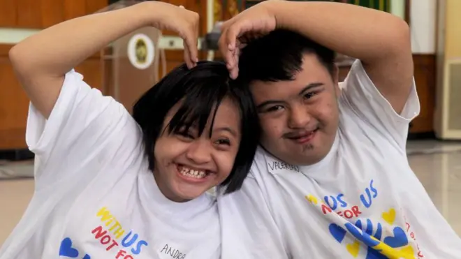 متلازمة داون.