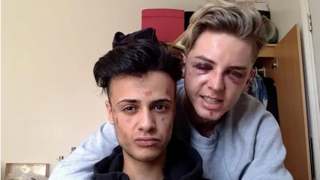 詹姆斯和戴恩被攻擊後